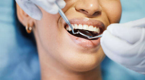 Best Broken or Chipped Tooth Repair in Sun Prairie, WI